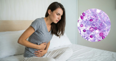 Secretaría de Salud confirma 33 casos de ciclosporiasis y rechaza ser origen del brote en Estados Unidos